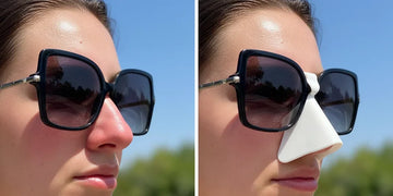 Split comparison showing sunburned nose versus UV-protected nose outdoors.