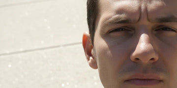 Nose and ears exposed to strong sunlight during outdoor activity.